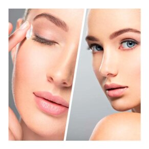 Hiệu ứng kem điều trị bằng cách điều trị bằng cách điều trị bằng cách điều trị Biovene VITAMIN C EYE BOOST age-correcting illuminating under...