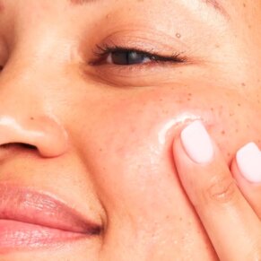 BYE BYE DARK SPOTS niacinamide serum Kem điều trị mụn chính hãng IT Cosmetics