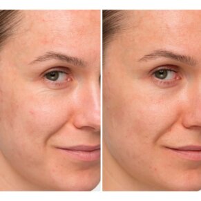 CONFIDENCE in a cream Kem chống lão hóa & Điều trị chống nhăn chính hãng IT Cosmetics